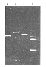 多发性硬化外周血单个核细胞 IL-2及TGF-β mRNA表达研究
