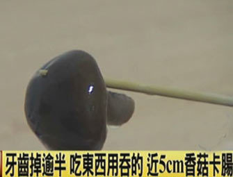 全球最怪异人体：肺里能长树
