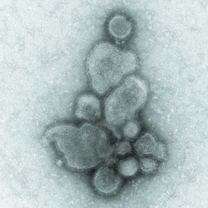 H7N9从哪里来到哪里去？会像SARS一样消失吗？