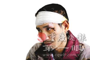 男子赴婚宴如厕坠下十楼受轻伤 医生称是奇迹