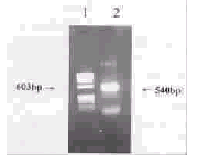 人FasL分子的克隆、表达及多抗制备