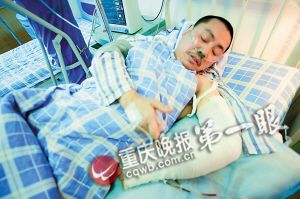 “冷静哥”左臂卷入机床仅剩皮 惨祸瞬间拉下电闸