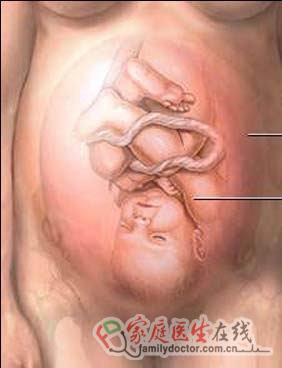 医学图解：剖腹产手术全过程