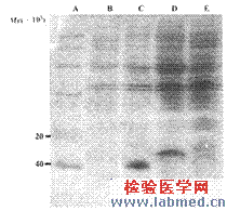 戊型肝炎病毒线性抗原表位克隆及表达的初步研究