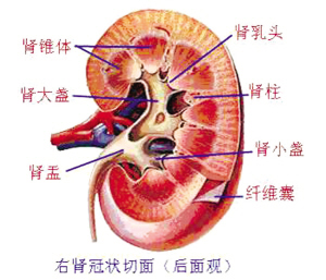 肾结石，营养过剩是祸根