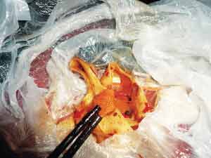 顾客餐厅吃鱼吃出用过创可贴 饭店拒绝顾客要求
