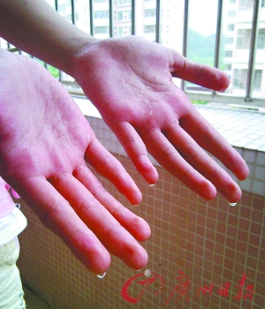 女孩双手爱“哭泣” 13年来不敢主动握手