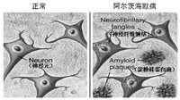 理清人脑“高速路网”