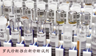 新一代检测试剂运力丙肝筛查