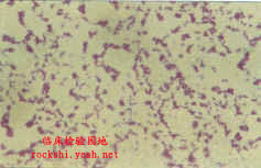 常见革兰阳性球菌图谱