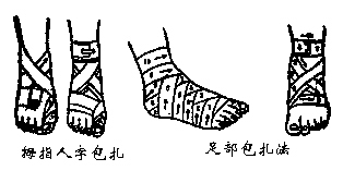 不同部位的绷带包扎步骤