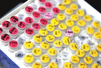 四川省医院将建生物银行：存入基因预测突发疾病