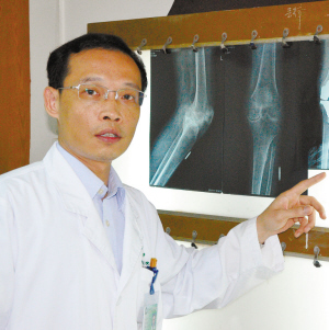 重度膝关节炎 别拒绝关节置换