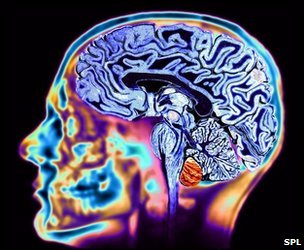 PNAS：大脑扫描戳穿“欺骗”行为