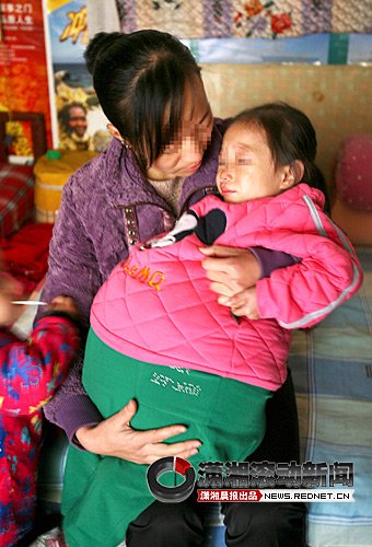 4岁女童患病肚大如孕妇 数万网友爱心接力援助