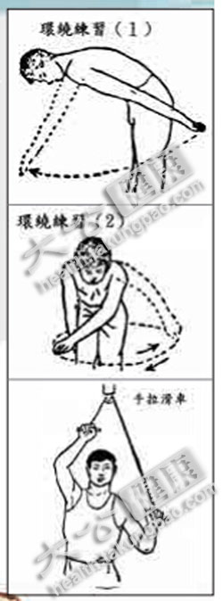 肩关节周围炎的功能锻炼汤水食疗
