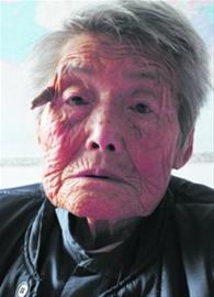 98岁老太头上长“犄角” 长约6厘米硬如牛角