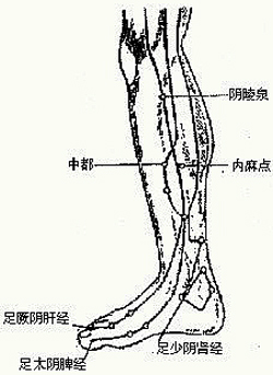 术后止痛针刺内麻点