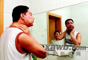 我国换脸第一人回家探亲