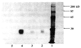 抗皂角毒、表皮生长因子受体双功能抗体的制备与体外效应的研究