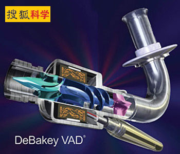 美科学家打造人造心脏 让患者不再有脉搏