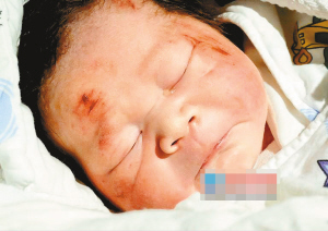 孕妇被撞婴儿“飞”出母体 孩子梦中流下眼泪