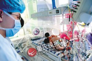 专家会诊双头女婴判断其属于单体