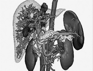 研发智能机器 破解医学难题