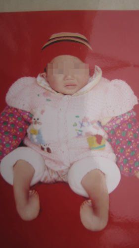 孕妇12次产检生下畸形儿 医院称没有责任