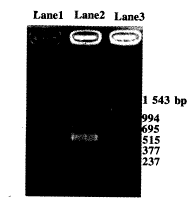 逆转录病毒载体介导的人白细胞介素10在大鼠心肌细胞的表达