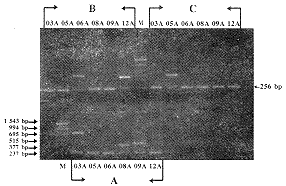 HLA-A位点PCR-SSP基因分型和血清学分型的比较