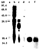 人重组TFAR19蛋白对白血病细胞株HL-60的促凋亡效应①