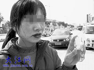 文唇不成反变“香肠嘴”