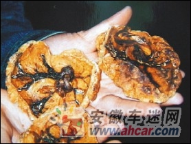 河南：部分医院倒卖人体胎盘 贩卖者发财谁来管？