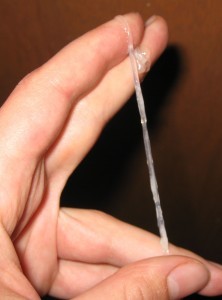 医学探索：实拍未育女性经期宫颈每天变化