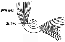 咽鼓管异常开放症
