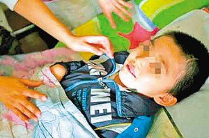 男童两年前在体校训练跳水时摔成植物人