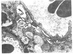 肾病综合征大鼠模型的建立及酶酚酸酯对其作用的实验研究