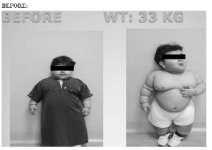 最年轻减肥男：两岁！