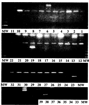 用PCR-SSP作HLA-B位点分型及B22亚型分析①