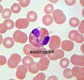 嗜酸性粒细胞（Eosinophil）