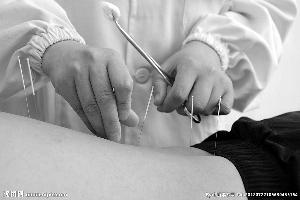 针灸对膝关节炎无效？中医针灸在美陷大规模论战