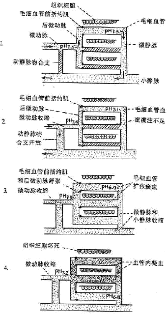 失血性休克