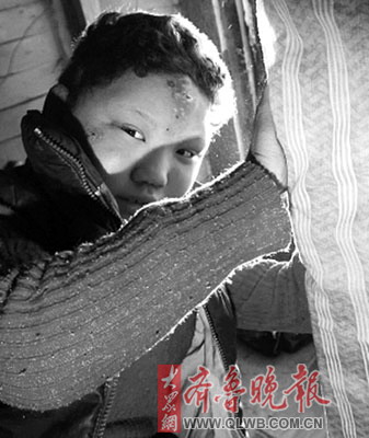 11岁女孩患怪病5年来频繁自虐