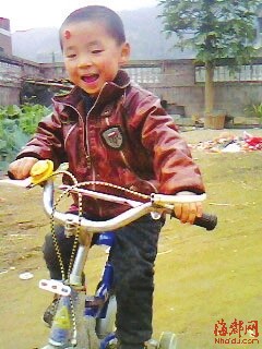 四岁男童经历高烧染怪病 全身器官“起火”