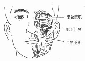 颌周峰窝织炎