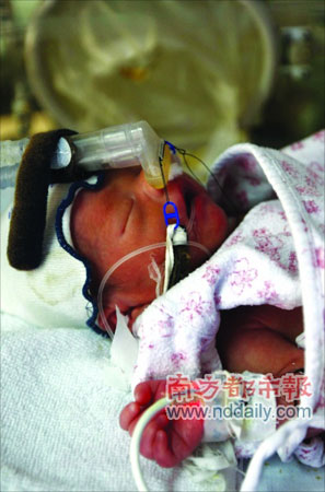 孕妇一分钟内顺产三胞胎