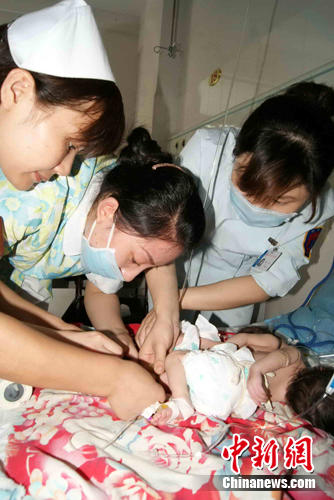 重庆医院千里驰援救助贵州新生连体婴