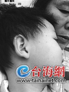 超市毒鼠药放置食品货架上 2岁小孩误食后中毒