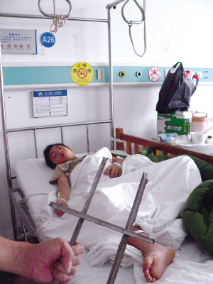 躲猫猫 男童爬屋顶 摔下来 钢条戳膝盖
